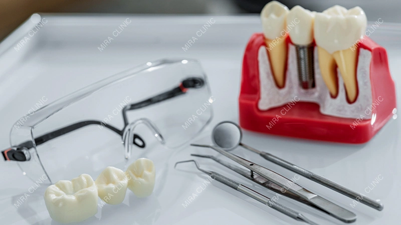 Dental Implant